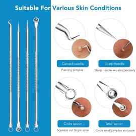 Blackhead Remover, Pimple Popper Tool kit, Blemish,Whitehead, Acne and Zit Removal, Pimple Extractor Tools with Metal Case Blackhead Remover, Pimple Popper Tool kit, Blemish,Whitehead, Acne and Zit Removal, Pimple Extractor Tools with Metal Case