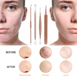 Pimple Popper Tool Kit, MENOLY 10 Pcs Blackhead Remover Comedone Extractor Acne Removal Kit for Blemish, Whitehead Popping,Zit Removing for Nose Face Tools with a Leather Bag (Rose Gold)