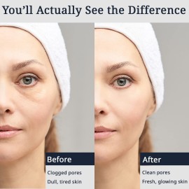 Sonic Face Cleansing Brush - Silicone Face Brush for Men & Women - Gentle Massaging and Vibrating Face Brush Cleanser - Rechargeable Silicone Face Scrubber Electric with Soft Bristles Sonic Face Cleansing Brush - Silicone Face Brush for Men & Women - Gentle Massaging and Vibrating Face Brush Cleanser - Rechargeable Silicone Face Scrubber Electric with Soft Bristles