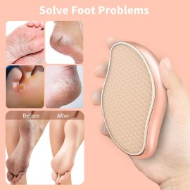 VANWIN Foot File, Nano Crystal Glass Callus Remover Callus Shaver Hard Skin Remover for Wet and Dry, Professional Foot Rasp Pedicure Tools Foot Care for Dead Hard Cracked Thick Dry Skin VANWIN Foot File, Nano Crystal Glass Callus Remover Callus Shaver Hard Skin Remover for Wet and Dry, Professional Foot Rasp Pedicure Tools Foot Care for Dead Hard Cracked Thick Dry Skin