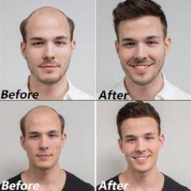 LLWear Human Hair Toupee for Men Soft Thin Skin (0.06mm) V-loop knot Hairpieces for Men 8x10 Inch Base Cap Mens Hair Replacement System mens toupee hair system 1B30(Off Black with 30% Grey Hair) LLWear Human Hair Toupee for Men Soft Thin Skin (0.06mm) V-loop knot Hairpieces for Men 8x10 Inch Base Cap Mens Hair Replacement System mens toupee hair system 1B30(Off Black with 30% Grey Hair)