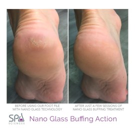Spa Sciences Nano Glass Foot File - Exfoliating Pedi Tool - Targets Dry Skin, Corns, Calluses - Wet or Dry Use - All Skin Types