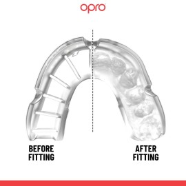 OPRO Silver Level Adult and Youth Sports Mouthguard with Case, Gum Shield Featuring Revolutionary Fitting Technology for Hockey, Lacrosse, Rugby, MMA, Boxing and Combat Sports (Clear/Clear)