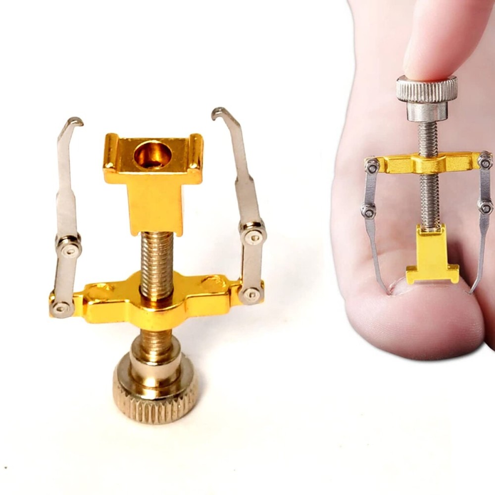 OdontoMed2011 Ingrown Toenail Corrector Stainless Steel Pedicure Tools for Curve Correct Ingrown Toenail Treatment, Tools for Ingrown Toenail Manicure Clipper Pedicure Fixer NL-CTR-01