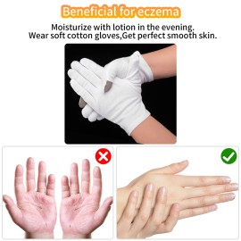 Sibba 3 Pairs Touch Screen Moisturizing Gloves White Cotton Moisturizing Gloves Overnight Bedtime Heal Eczema Sleeping Lotion Hand Spa Treatment Gloves Repair Rough Cracked Dry Chapped Hands Skin Sibba 3 Pairs Touch Screen Moisturizing Gloves White Cotton Moisturizing Gloves Overnight Bedtime Heal Eczema Sleeping Lotion Hand Spa Treatment Gloves Repair Rough Cracked Dry Chapped Hands Skin