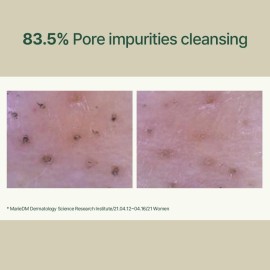 Pyunkang Yul Calming Low pH Foaming Cleanser | Daily Face Wash & Makeup Remover with Tea Tree, Centella Asiatica, 5 Hyaluronic Acids that Removes Dead Skin Cells, Hydrates Skin - 150ml 5.07 Fl.Oz.