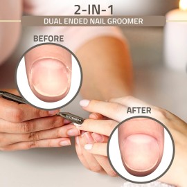 Utopia Care Cuticle Pusher Tool & Spoon Nail Cleaner, Professional Stainless Steel Cuticle Remover & Cutter, Durable Manicure & Pedicure Tool for Finger & Toenails, Bronze Utopia Care Cuticle Pusher Tool & Spoon Nail Cleaner, Professional Stainless Steel Cuticle Remover & Cutter, Durable Manicure & Pedicure Tool for Finger & Toenails, Bronze