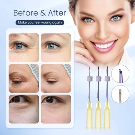 Pdo Smooth Mono Threads - Fills Eye Wrinkles, Blunt 30G 25 MM (20 Pieces) Pdo Smooth Mono Threads - Fills Eye Wrinkles, Blunt 30G 25 MM (20 Pieces)