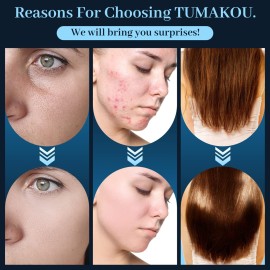 High Frequency Facial Wand - TUMAKOU Portable Handheld Blue High Frequency Facial Machine - 4 Different Blue Glass Tubes for Skin High Frequency Facial Wand - TUMAKOU Portable Handheld Blue High Frequency Facial Machine - 4 Different Blue Glass Tubes for Skin