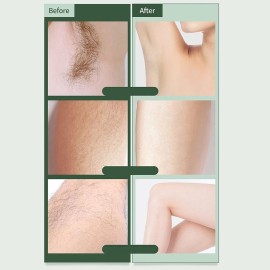 Bikini Shaver and Trimmer Hair Remover for Women Portable Electric with LED Light Hair Remove for Any Part of The Body Bikini Shaver and Trimmer Hair Remover for Women Portable Electric with LED Light Hair Remove for Any Part of The Body