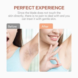 4 Count Facial Hair Remover Replacement Heads with 1 Cleaning Brush, for Flawless Finishing Touch Facial Hair Removal Tool for Women 4 Count Facial Hair Remover Replacement Heads with 1 Cleaning Brush, for Flawless Finishing Touch Facial Hair Removal Tool for Women