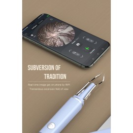 Hair Removal Tweezer with 1080p Camera, Ultimate Precision: Tweezer with Camera - Perfect for Delicate Tasks! - - Ear Hair Eyebrow Tweezer