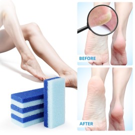 4 Pcs Foot Pumice Stone and Scrubber for Feet and Heels Callus and Dead Skins (Blue) 4 Pcs Foot Pumice Stone and Scrubber for Feet and Heels Callus and Dead Skins (Blue)