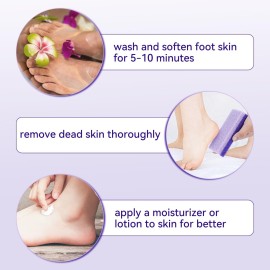 4 Pcs Foot Pumice Stone and Scrubber for Feet and Heels Callus and Dead Skins (Purple) 4 Pcs Foot Pumice Stone and Scrubber for Feet and Heels Callus and Dead Skins (Purple)