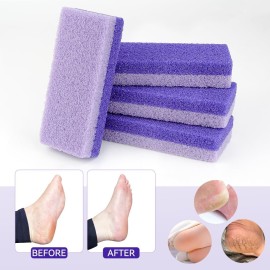 4 Pcs Foot Pumice Stone and Scrubber for Feet and Heels Callus and Dead Skins (Purple) 4 Pcs Foot Pumice Stone and Scrubber for Feet and Heels Callus and Dead Skins (Purple)