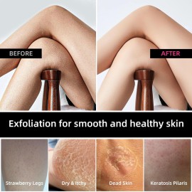 Deep Exfoliating Back Scrubber -Bath & Shower Back Scrub - Body Exfoliator Scrub Tool - Skin Care for Women & Men - Exfoliation Body Scrubber for Shower