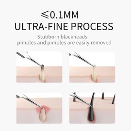 3Pcs Professional Blackhead Tweezer Professional Facial Blackhead Remover Tweezers Precision Extractor Acne Removal Kit Pimple Popper Tool with storage box
