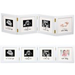 Beeveer Sonogram Picture Frame Quadruple Ultrasound Picture Frame 4 Folding Pregnancy Keepsake Photo for Pregnancy Announcements First Time to Be Dad Mom Gifts Gender Nursery Decor(White)