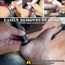 Electric Callus Remover for Feet, Adjustable Various Speed, Powerful Electric Foot File Sander Grinder Pedicure Hard Dead Skin Remover with 60 Sandpaper Discs and Dust Brush, Black FCR-1 Electric Callus Remover for Feet, Adjustable Various Speed, Powerful Electric Foot File Sander Grinder Pedicure Hard Dead Skin Remover with 60 Sandpaper Discs and Dust Brush, Black FCR-1