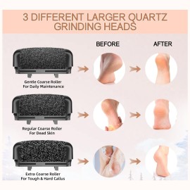 AdamPark Callus Removers 8 Pack Replacement Rollers Heads for Electric Feet File Pedicure Tools, Pedicure Kit Refill Rollers 3 Extra Coarse, 3 Regular Coarse, 2 Fine Coarse Refill Rollers